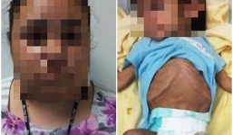 Mẹ bỏ đói con gái 3 tuổi vì chồng không chịu ly hôn