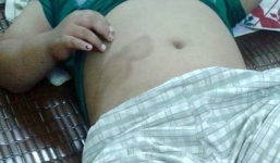 Bắc Giang: Mẹ đẻ tố con trai bị đánh đập dã man