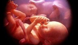 Quan hệ với 2 người đàn ông trong 1 tuần, mang thai song sinh khác cha