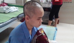 Nữ sinh viên bị người yêu cuồng ghen đánh bất tỉnh