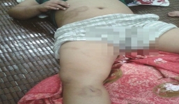 Hàng xóm kể chuyện bé 9 tuổi bị bạo hành ở Bắc Giang