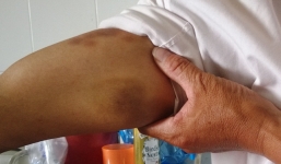 Giáo viên đánh bạn nhập viện vì tranh cãi tên hiệu trưởng cũ