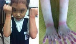 Phẫn nộ giáo viên trói tay học sinh vì nghi trộm tẩy của bạn