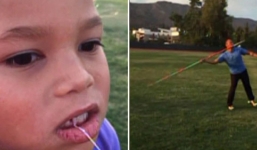 Clip: Nhổ răng cho con kiểu VĐV Olympic