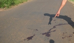 Hãi hùng phát hiện thi thể mất một tay trái