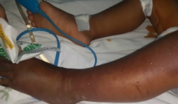 Rắn độc chui vào võng cắn chết bé trai hơn 2 tuổi