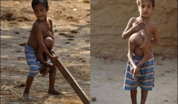 Kỳ lạ cậu bé có 4 tay, chân ở bụng được tôn sùng như thần