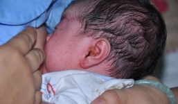Phát hiện giòi trong tai bé sơ sinh