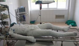 Xót xa bé trai 13 tuổi bị tím đen toàn thân, quần áo cháy tan do bỏng điện cao thế