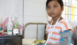 Người cha đánh đập, ném con gái 10 tuổi xuống giếng bị khởi tố