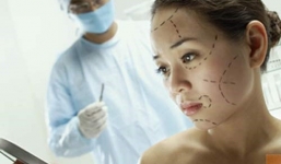 Lý giải lời nguyền phụ nữ gò má cao dính họa 