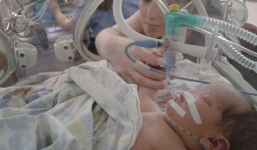 Kỳ diệu ca phẫu thuật 3D cho cô bé sinh ra không có mũi