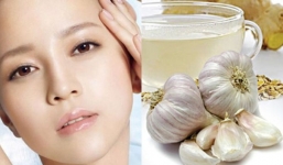 Cách trị mụn đầu đen bằng tỏi rất nhanh và hiệu quả