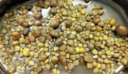 Sốc: Người đàn ông mang 420 viên sỏi trong thận vì nghiện đậu phụ