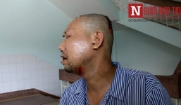 Giang hồ đất Cảng truy sát 2 anh em ruột trong quán bia