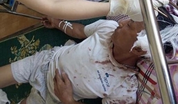 50 giang hồ tấn công ông lão 65 tuổi: Triệu tập một giám đốc công ty