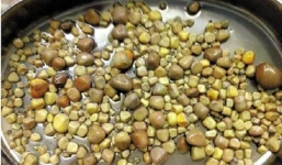 Người đàn ông mang 420 viên sỏi thận trong người vì ăn quá nhiều đậu phụ