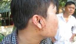 Yêu cầu điều tra vụ phóng viên Báo Giao thông bị hành hung