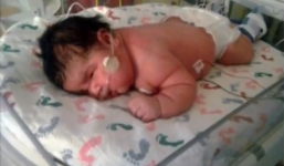 Cận cảnh bé sơ sinh “khổng lồ” nặng 18 kg phá vỡ kỷ lục thế giới