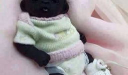 Sự thật về 'em bé Nam Phi' đen nhất thế giới