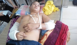 5 thanh niên bị 3 kẻ bịt mặt xông vào đâm chém dã man