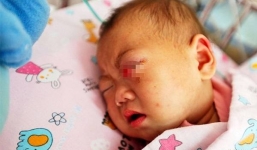 Xót thương bé gái 9 tháng tuổi bị cha nhẫn tâm chọc mù mắt 