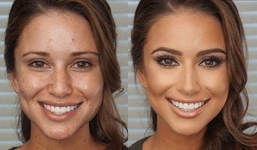 Bất ngờ với gương mặt đầy mụn của hoa hậu Mỹ