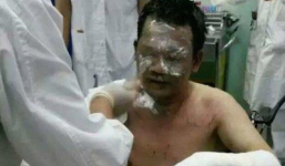 TQ: Bệnh nhân giận dữ tạt xăng thiêu sống bác sĩ