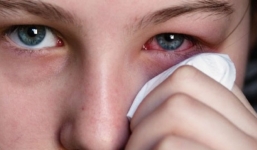 Mùa hè và những bệnh thường xuyên mắc phải