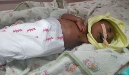 Cha mẹ chối bỏ đứa con 2 tuần tuổi vì hình dạng kỳ dị