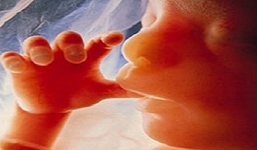 Bất ngờ phát hiện bào thai 50 năm trong bụng bà cụ 90 tuổi