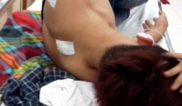 Nam thanh niên chém một công nhân trọng thương