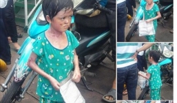 Sự thật chuyện cháu bé nằm trong 'đường dây chăn dắt ăn xin'