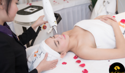 Dùng tia Lase có thực sự trị hết nám?