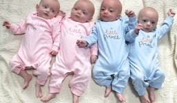 Hy hữu, ca sinh tư tự nhiên từ 4 trứng riêng biệt