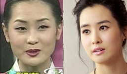 Nhan sắc xấu xí khi chưa phẫu thuật thẩm mỹ của các sao Hàn