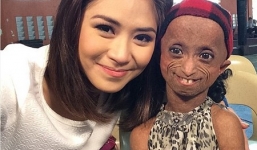 Thiếu nữ 18 tuổi “mắc kẹt” trong thân hình cụ bà 144 tuổi