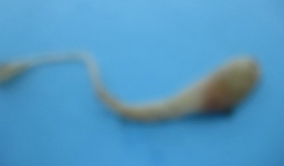 Sinh vật lạ giống rắn trong trứng gà ở Hải Dương