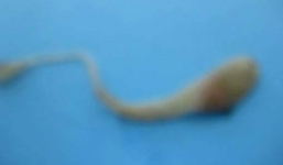 Sự thật rắn con ngoe nguẩy sống trong quả trứng gà