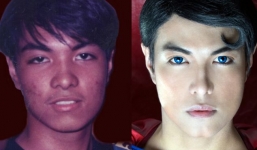 Người đàn ông phẫu thuật 23 lần để trở thành… siêu nhân