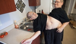 Nghị lực phi thường của cặp song sinh dính liền thân già nhất thế giới