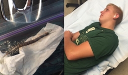 Hoảng hồn phát hiện con rết dài 10 cm bò ra khỏi tai