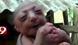 Phẫn nộ cha mẹ bỏ rơi con sơ sinh vì hình dạng giống cụ già