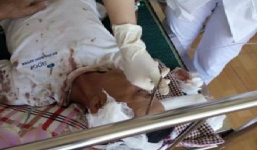 Vụ thuê 50 côn đồ truy sát bố chồng: Thế lực nào đứng sau?