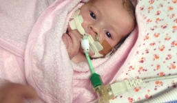 Em bé 23 ngày tuổi hiến tặng thận cứu người