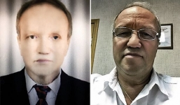 Từ người đàn ông da trắng chuyển thành da màu sau khi ghép gan