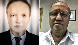 Da trắng chuyển thành da đen sau khi trải qua phẫu thuật ghép gan