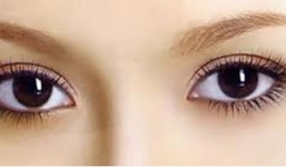 Cách chăm sóc và bảo vệ đôi mắt cho dân văn phòng