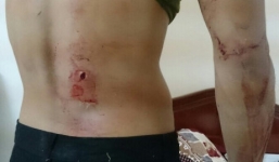 Nhóm cascadeur bị hành hung rút đơn yêu cầu khởi tố vụ án