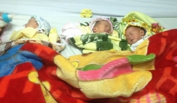 Mổ thành công ca sinh 3 khác trứng hiếm gặp tại Quảng Bình